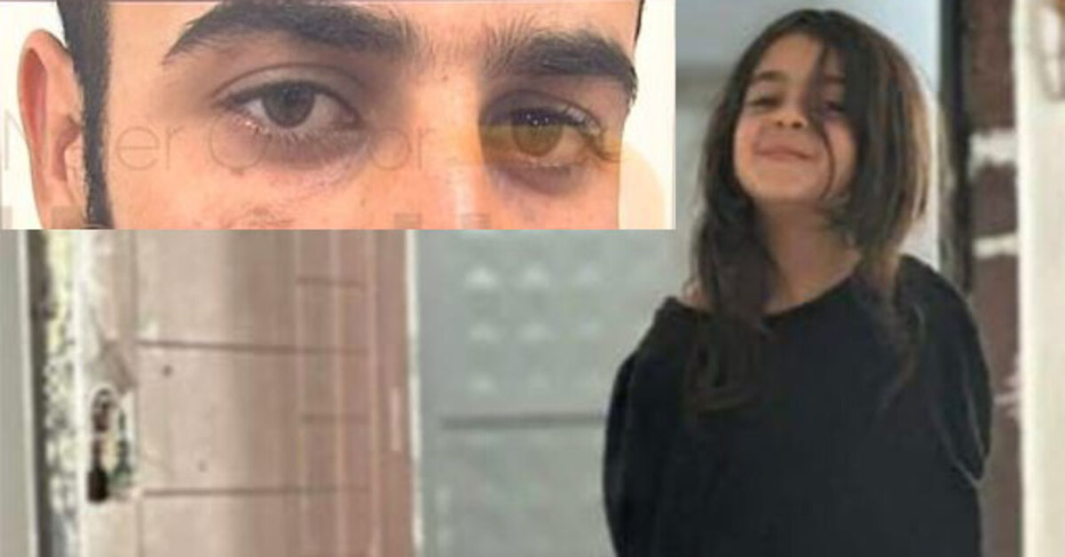 Enes Güran’ın gözünün altındaki diş izi!